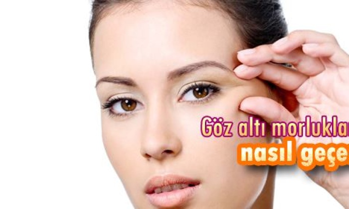 Göz Altı Morlukları Neden Oluşur?