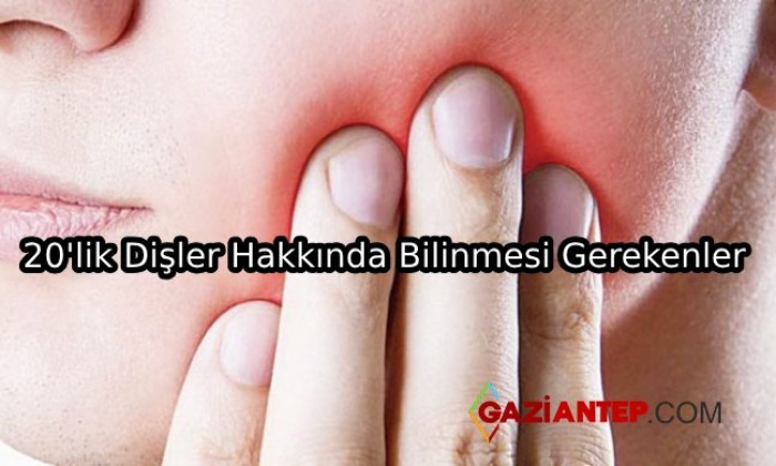 20 Yaş Dişleri Hakkında