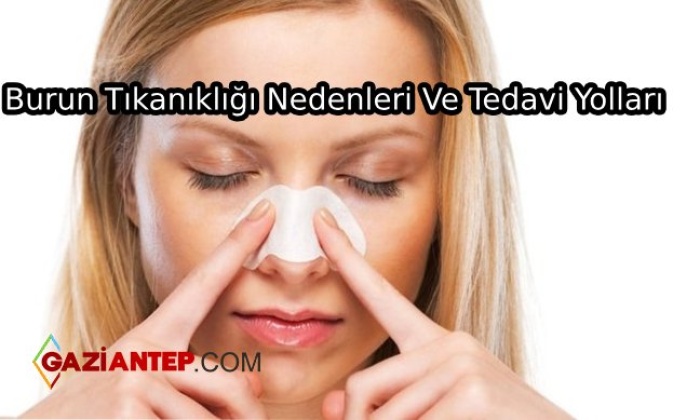 Burun Tıkanıklığı Nedenleri Ve Tedavi Yolları