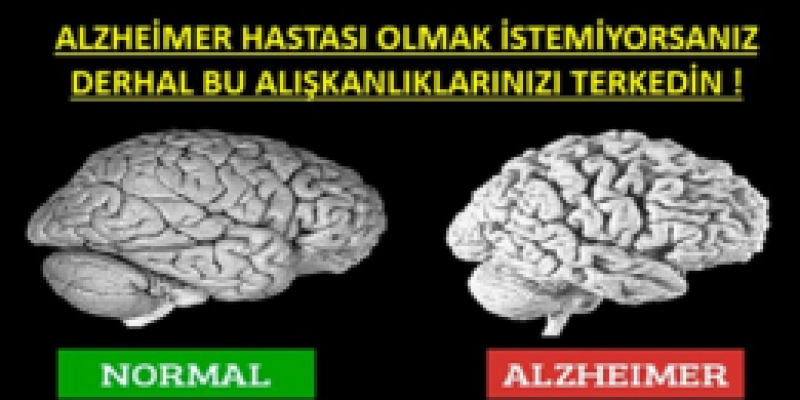 Alzheimer Olmak İstemiyorsanız Bırakın…