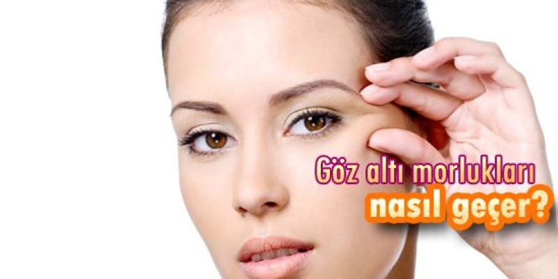Göz Altı Morlukları Neden Oluşur?