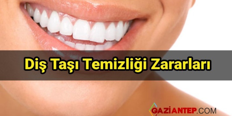 Diş Taşı Temizliği Zararları